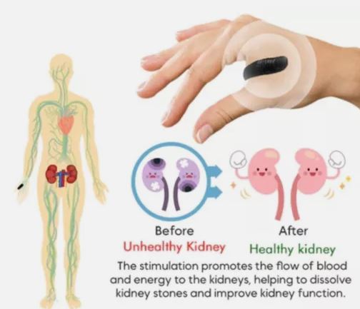 Doctor Approved™ Sugar Control LI4 Acupressure Point Clip 🇩🇪